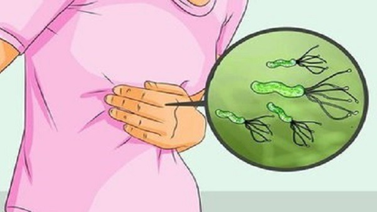 出現(xiàn)胃疼、腹脹應(yīng)提防感染幽門(mén)螺桿菌